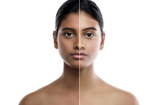 Skin Lightening Whitening.jpg